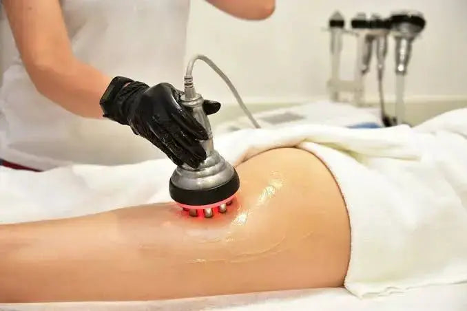 RF cellulite skin fighting treatment Anaheim Body sculpting