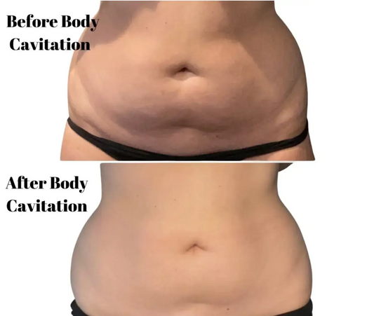 3 session bundle with 3 body wraps